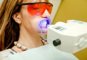 Bleaching der Zähne