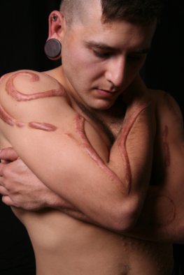 Body Modificater mit Brandings auf dem Arm