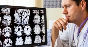 Arzt sitzt an einem Bildschirm und begutachtet die tomographischen des Gehirns