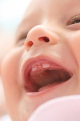 Die ersten Milchzähne - Keine Nahrung mit Zucker für Babys