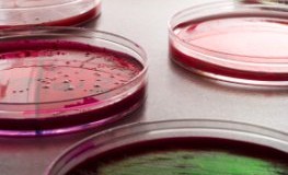 Das EHEC-Bakterium als Kultur im Petriglas