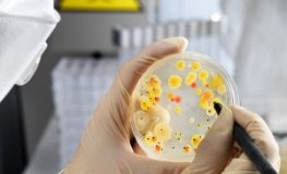Epidemien - Bakterien in einer Petrischale