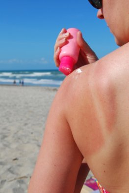 Hautkrebsrisiko - der Sonnenbrand wird immer noch unterschätzt