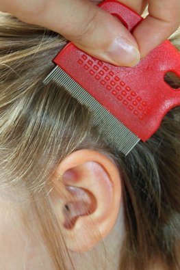 Kopfläuse - Läusebefall: Haare kämmen mit einem Läusekamm