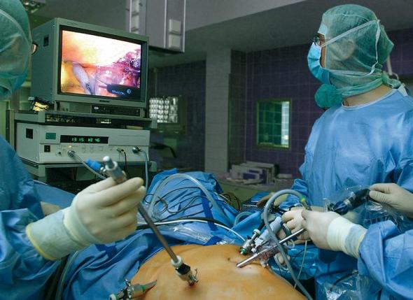 Darmkrebs-Operation an einem Patienten