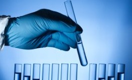 Nutrigenomik - Analyse im Labor