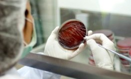 Petrischale - Bakterien und Keime werden im Labor getestet