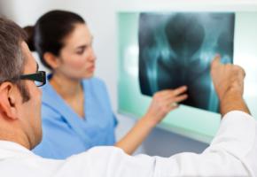 Arthrose: Forscher untersuchen Röntgenaufnahme nach Verformungen der Hüftgelenke.