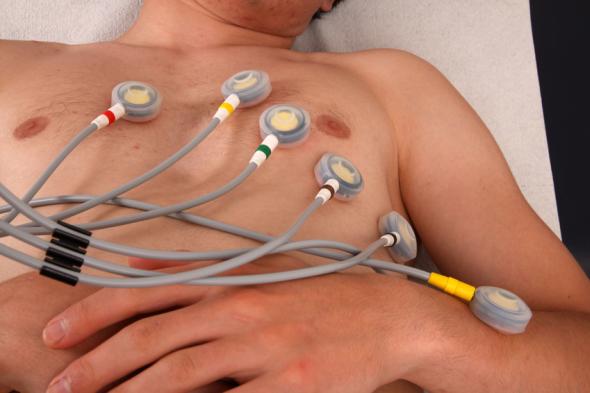 Schlaganfall - EKG bei einem jungen Menschen