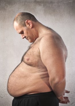 Sind die Gene schuld? Dieser Mann leidet unter seiner Fettleibigkeit (Adipositas).
