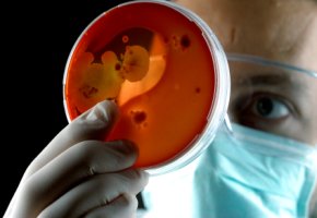 Tödlicher Darmkeim - das EHEC-Bakterium in einer Kultur