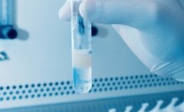 Zellforschung: Forscher untersuchen Spermien im Labor