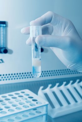 Zellforschung: Forscher untersuchen Spermien im Labor